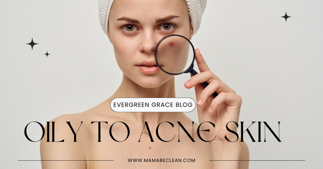 Natural Skincare Solutions for Oily and Acne-Prone Skin